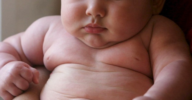 Obesidad Infantil